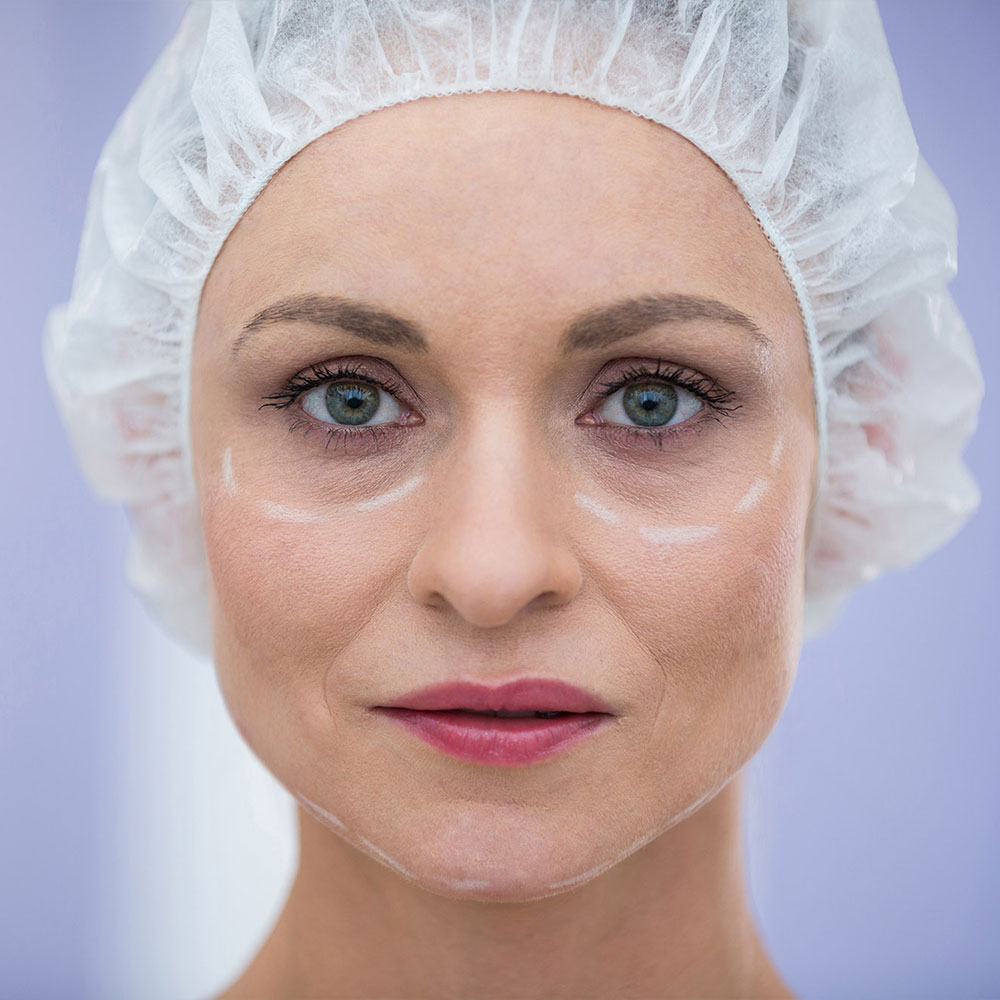Fides Oculoplastic treatment